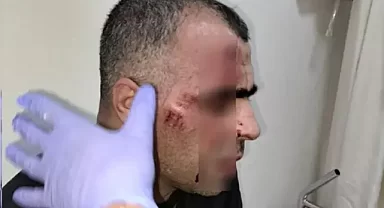 Gazeteci Sinan Aygül'e saldıran polis memuru açığa alındı