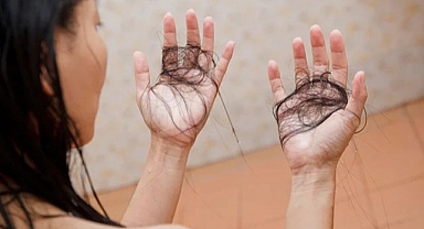 Saçlarınız mı dökülüyor? Bu şampuanlardan uzak durun