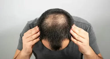 Kellik tarih oluyor!