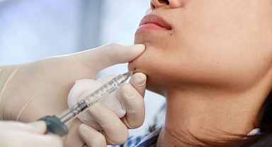 Çene Dolgusu ve Jawline Dolgusu ile Yüz Hatlarında Netlik