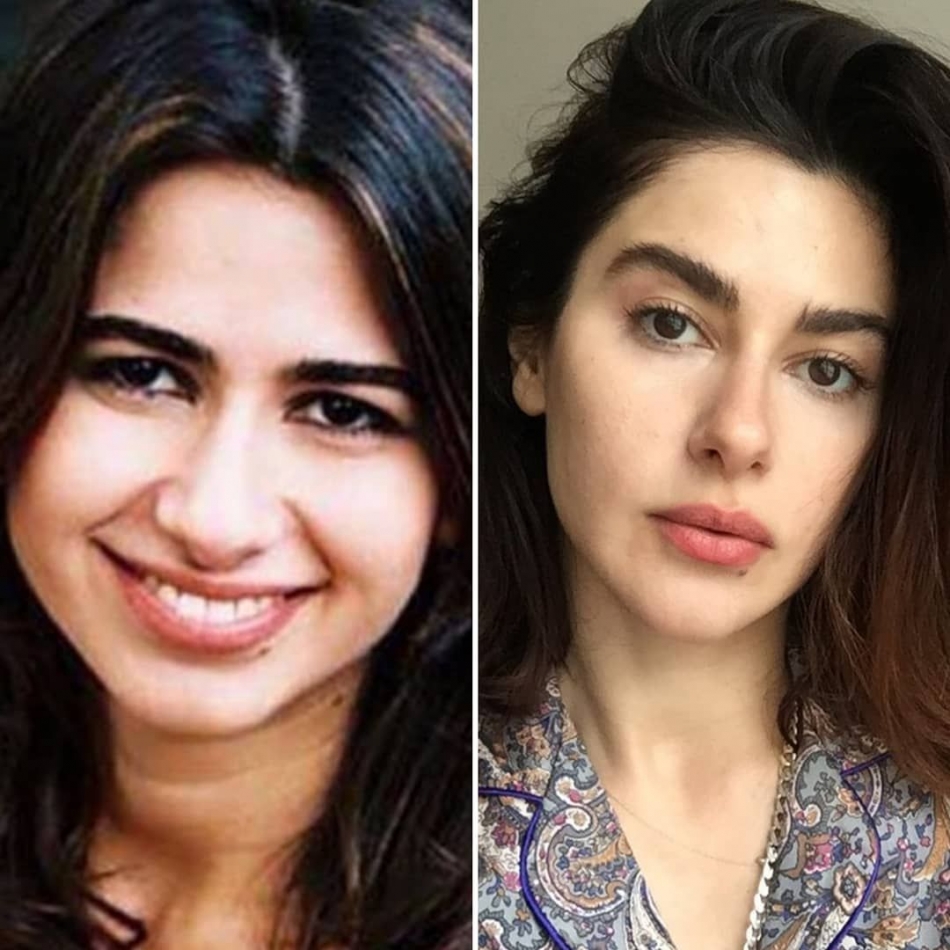 Ünlülerin estetiksiz hallerine çok şaşıracaksınız! 1