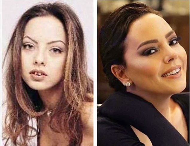 Ünlülerin estetiksiz hallerine çok şaşıracaksınız! 3