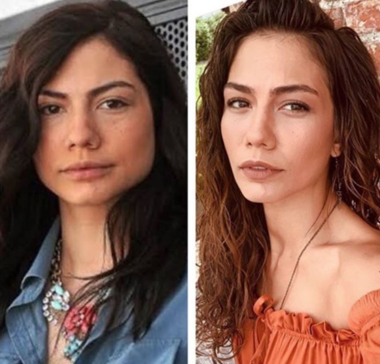 Ünlülerin estetiksiz hallerine çok şaşıracaksınız! 4