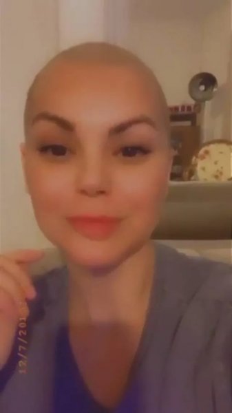 Bir döneme damgasını vuran Nez'in son hali şaşırttı! 2