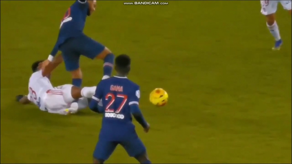 Neymar'a insanlık dışı faul, sezonu kapatmış olabilir! Baba Neymar: Oğlumu kurban ettiler! 4
