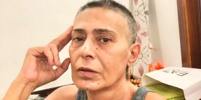 Yıldız Tilbe'nin yeni imajı 5
