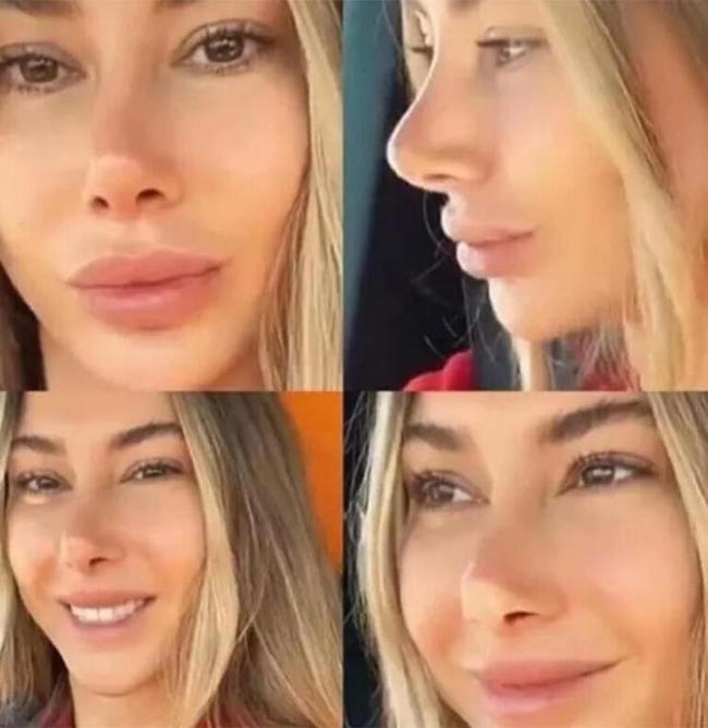 Şeyma Subaşı hastanelik oldu iddası 2